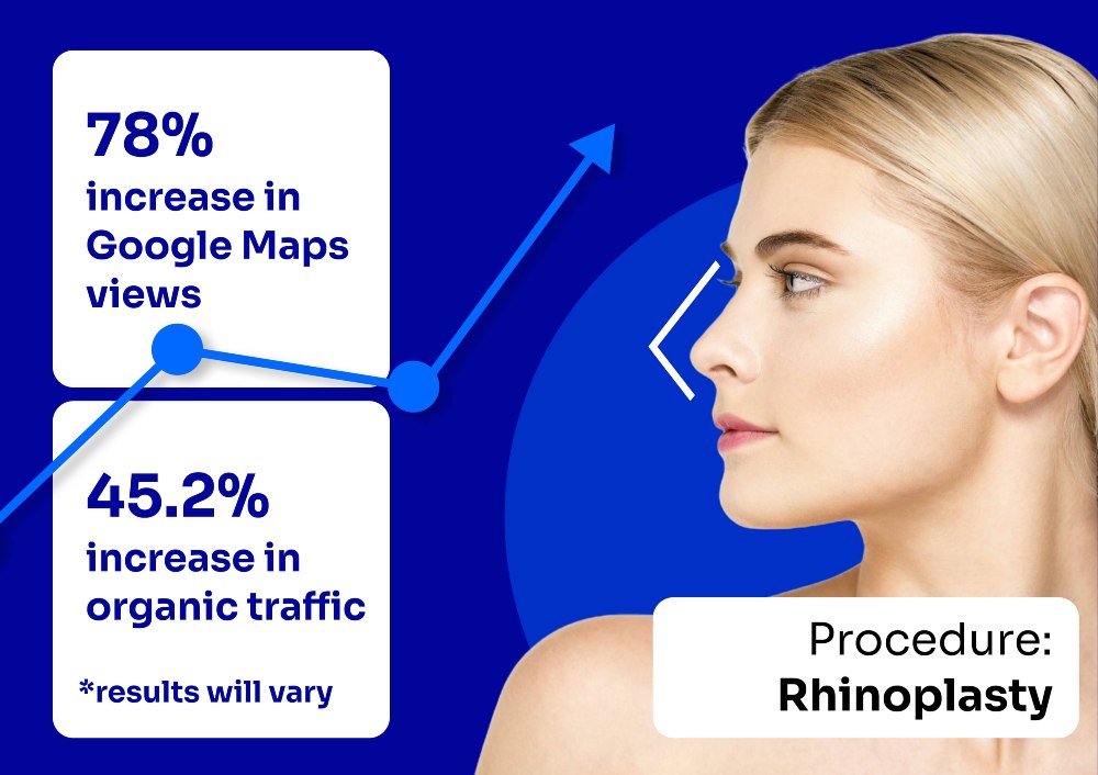 Rhinoplasty SEO Case Study | Copify Plastic Surgery Marketing Results